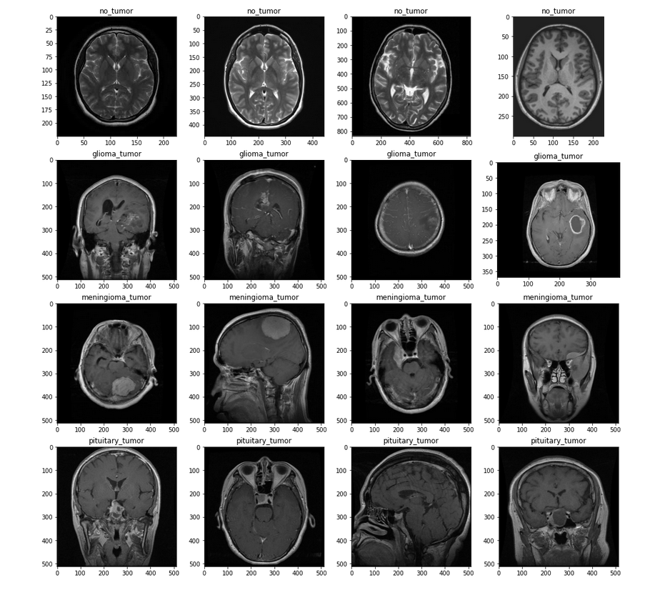 Neuro Scan — Automated Medical Image Diagnostic App